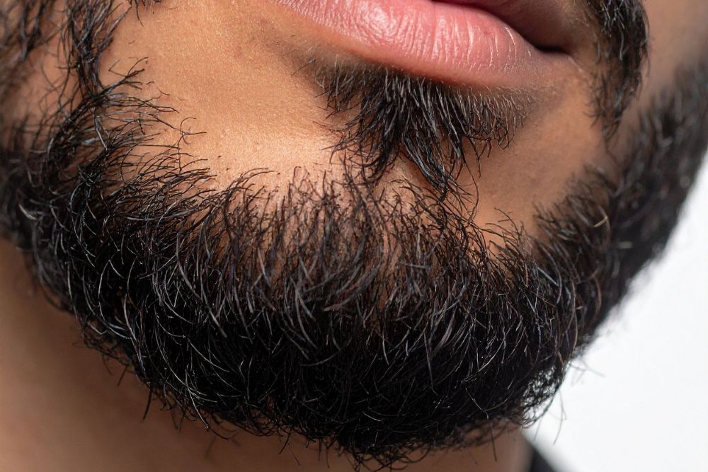 Abbildung eines längeren Dreitagebartes